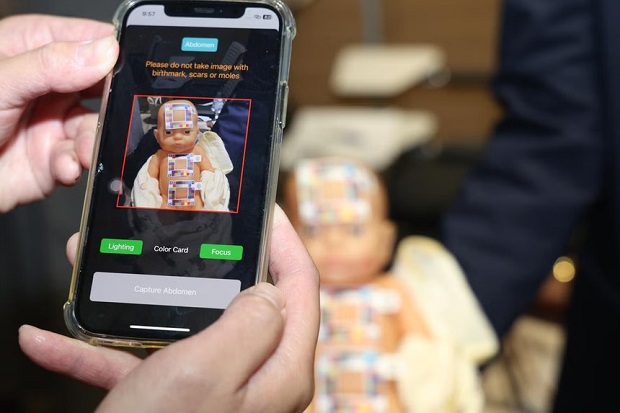  ​The app’s algorithm analyses the yellowness of the baby’s skin using photos of the infant with a specially designed colour-calibration sticker. PHOTO LIANHE ZAOBAO 