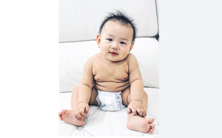 higher birth weight is associated with greater body mass index in childhood and later in life.