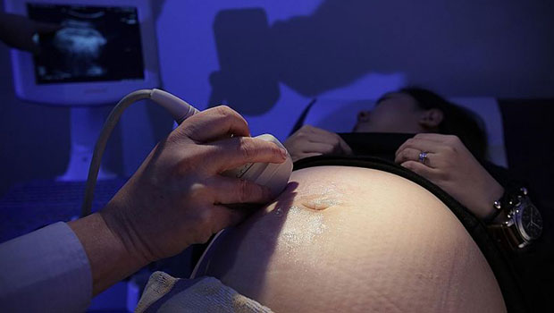  ​Singapore has one of the highest gestational diabetes rates in the world, with one in five births affected by it. In comparison, the International Diabetes Federation estimates that one in seven births worldwide is affected by the condition. 