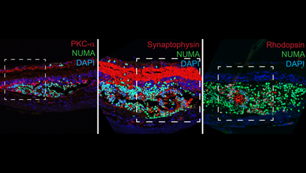  Regions of photoreceptor regeneration in the retinas of preclinical models (inside dashed boxes) highlighted by various molecular markers of photoreceptor function (named at top right).