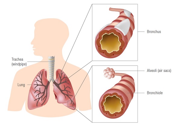 Lung Cancer Condition and Treatments - Diagram of Lungs