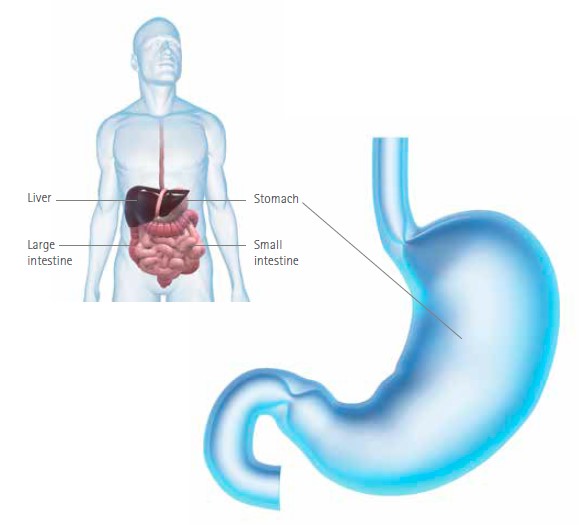 stomach affected by stomach cancer | SingHealth