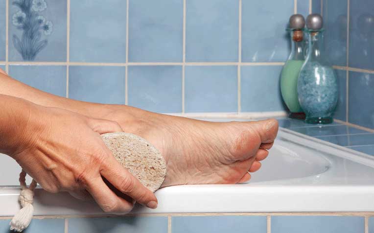 Foot corn and callus can be treated at home.