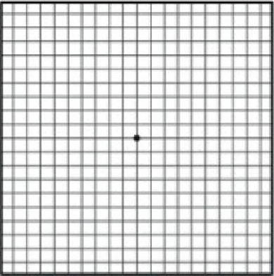 AMD Amsler Grid Chart - Age-related Macular Degeneration - Conditions and Treatments SingHealth 