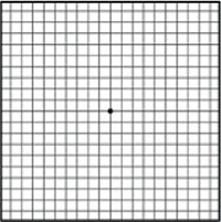 Normal Vision Amsler Grid - Age-related Macular Degeneration