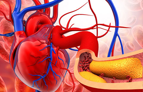 Cholesterol Management