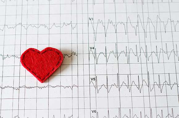 Tachycardia is a heart rhythm disorder that requires special attention | SingHealth